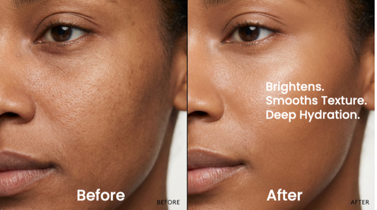 The Real Reason Your Skin Looks Dull — And It's Not Aging