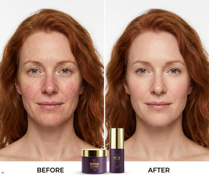 Snaykaa Physician-Founded DUO Face Serum & Gel Cream Set, Vegan, Made in USA