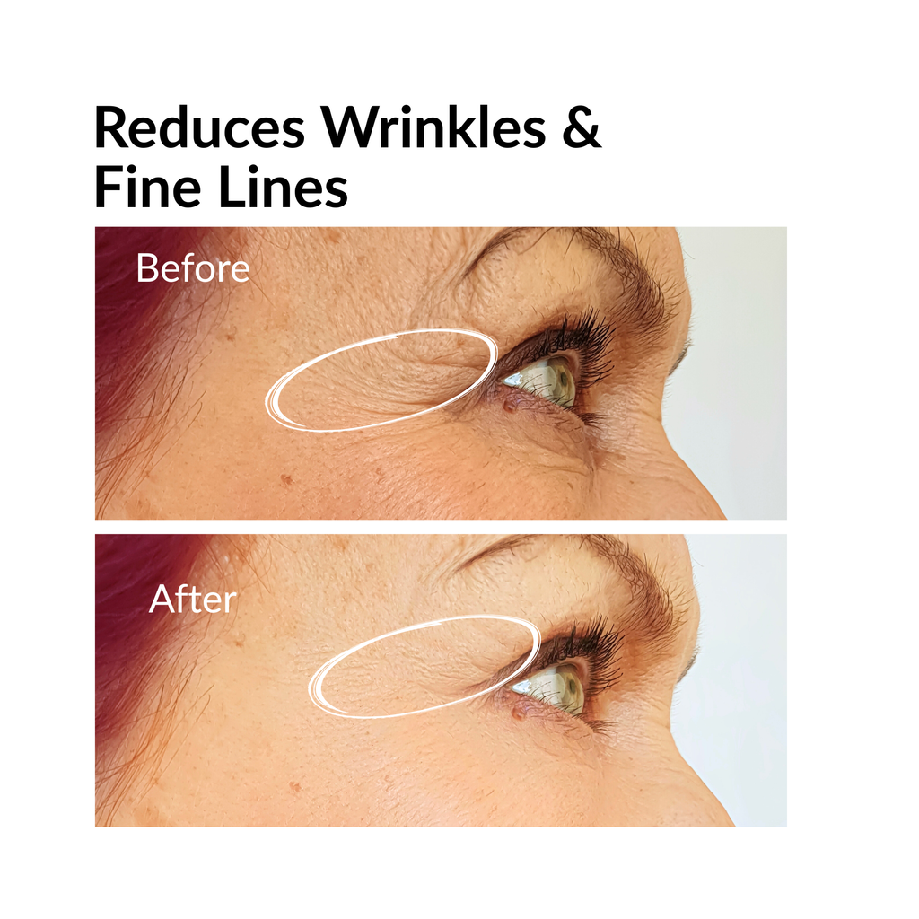 SNAYKAA™ ALL-IN VENOM Face Serum for Women | Anti-Aging & Wrinkle Reducer | Niacinamide, Mandelic Acid & Hyaluronic Acid | Hydrating, Brightening, Dark Spot Corrector | 30ml